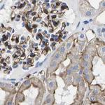 Dysferlin Antibody in Immunohistochemistry (IHC)