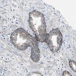 PTGFRN Antibody in Immunohistochemistry (Paraffin) (IHC (P))