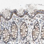 PTGFRN Polyclonal Antibody
