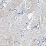 PTGFRN Antibody in Immunohistochemistry (Paraffin) (IHC (P))