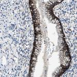 PTGFRN Antibody in Immunohistochemistry (IHC)