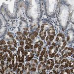 GALNT15 Antibody in Immunohistochemistry (Paraffin) (IHC (P))