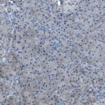 GALNT6 Antibody in Immunohistochemistry (Paraffin) (IHC (P))