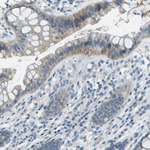 LGI2 Antibody in Immunohistochemistry (Paraffin) (IHC (P))