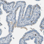 LGI2 Antibody in Immunohistochemistry (Paraffin) (IHC (P))