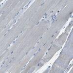 LGI2 Antibody in Immunohistochemistry (Paraffin) (IHC (P))