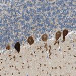 PLBD2 Antibody in Immunohistochemistry (Paraffin) (IHC (P))