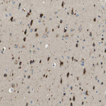 PLBD2 Antibody in Immunohistochemistry (Paraffin) (IHC (P))