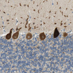 PLBD2 Antibody in Immunohistochemistry (Paraffin) (IHC (P))