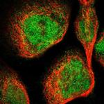 DGKE Polyclonal Antibody