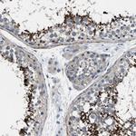 DGKE Antibody in Immunohistochemistry (Paraffin) (IHC (P))