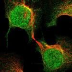 MED21 Polyclonal Antibody