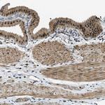 MED21 Antibody in Immunohistochemistry (IHC)