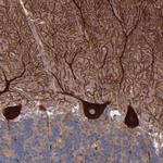 CI091 Antibody in Immunohistochemistry (Paraffin) (IHC (P))