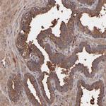 CI091 Antibody in Immunohistochemistry (Paraffin) (IHC (P))