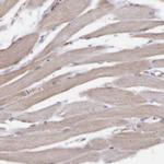 CI091 Antibody in Immunohistochemistry (Paraffin) (IHC (P))