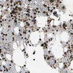 CACHD1 Antibody in Immunohistochemistry (Paraffin) (IHC (P))
