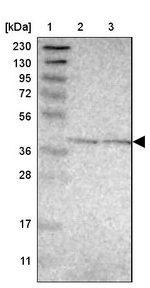 GINM1 Antibody in Western Blot (WB)