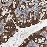 UBA5 Antibody in Immunohistochemistry (Paraffin) (IHC (P))