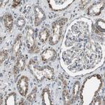 NRK Antibody in Immunohistochemistry (Paraffin) (IHC (P))