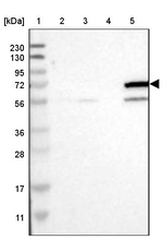 CYP4F11 Antibody in Western Blot (WB)
