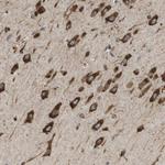 ST3GAL2 Antibody in Immunohistochemistry (Paraffin) (IHC (P))