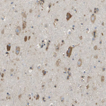 ST3GAL2 Antibody in Immunohistochemistry (Paraffin) (IHC (P))