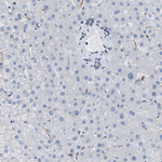 ST3GAL2 Antibody in Immunohistochemistry (Paraffin) (IHC (P))