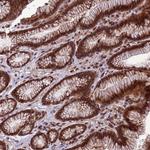 VSTM4 Antibody in Immunohistochemistry (Paraffin) (IHC (P))