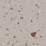 FAM69A Antibody in Immunohistochemistry (IHC)