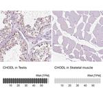 Chondrolectin Antibody in Immunohistochemistry (IHC)