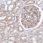 FRMD3 Antibody in Immunohistochemistry (IHC)