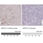 ARPP21 Antibody in Immunohistochemistry (IHC)