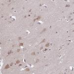 ARPP21 Antibody in Immunohistochemistry (IHC)