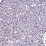 ARPP21 Antibody in Immunohistochemistry (IHC)