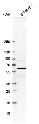 Spastin Antibody in Western Blot (WB)