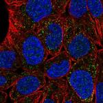 MLSTD2 Polyclonal Antibody