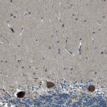MLSTD2 Antibody in Immunohistochemistry (Paraffin) (IHC (P))
