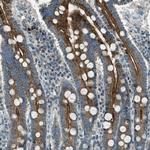 MLSTD2 Antibody in Immunohistochemistry (Paraffin) (IHC (P))