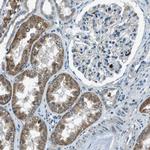 MLSTD2 Antibody in Immunohistochemistry (Paraffin) (IHC (P))