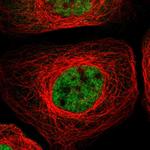 RBM5 Polyclonal Antibody