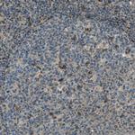 LEMD2 Antibody in Immunohistochemistry (Paraffin) (IHC (P))