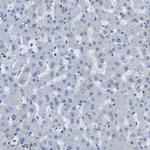 LPP Antibody in Immunohistochemistry (Paraffin) (IHC (P))