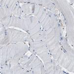 LPP Antibody in Immunohistochemistry (Paraffin) (IHC (P))