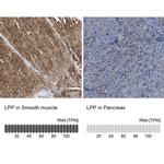 LPP Antibody in Immunohistochemistry (IHC)