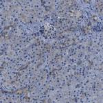 LPP Antibody in Immunohistochemistry (IHC)