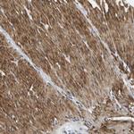 LPP Antibody in Immunohistochemistry (IHC)