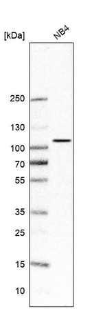 PALD1 Antibody in Western Blot (WB)