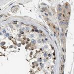 ZFPL1 Antibody in Immunohistochemistry (IHC)