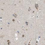 ZFPL1 Antibody in Immunohistochemistry (IHC)
